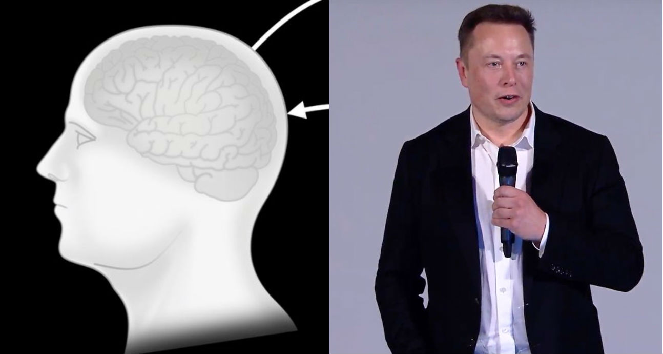 Посмотрите, как Илон Маск подробно рассказывает о разработке интерфейса мозга Neuralink