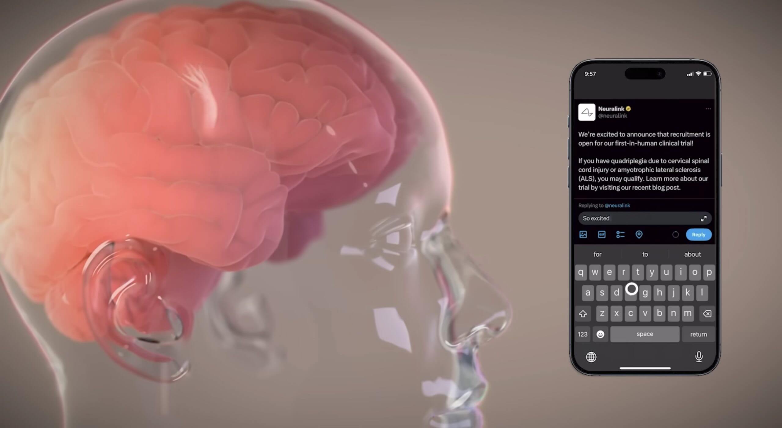 Илон Маск поделился подробностями «Телепатии», первого человеческого устройства Neuralink